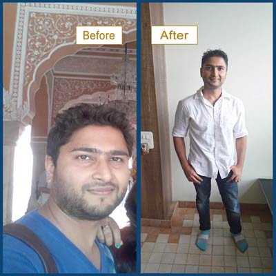 Before and After Transformation 7