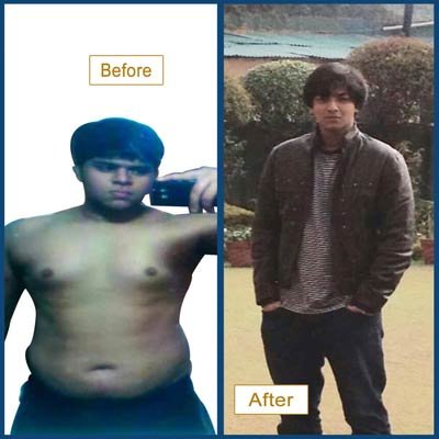 Before and After Transformation 8