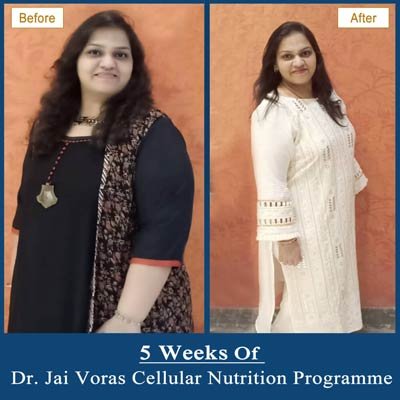 Before and After Transformation 9