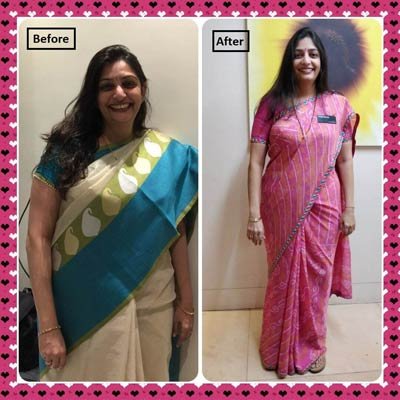 Before and After Transformation 7