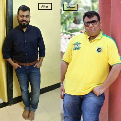 Before and After Transformation 8
