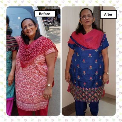 Before and After Transformation 9
