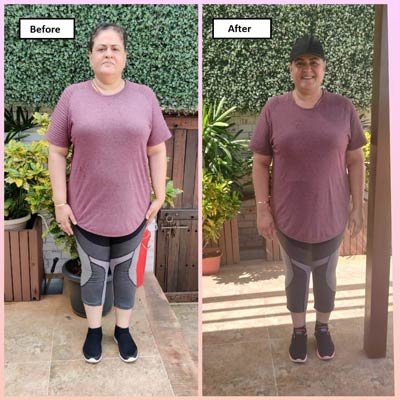 Before and After Transformation 7