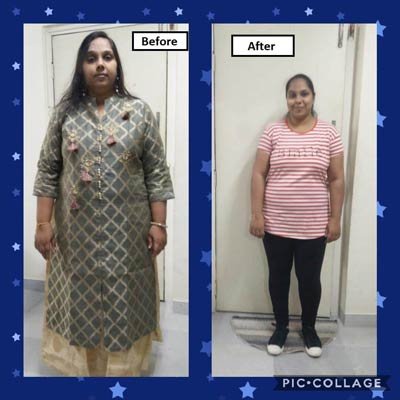 Before and After Transformation 8