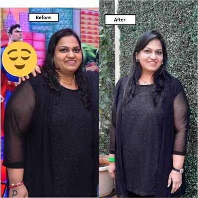 Before and After Transformation 9
