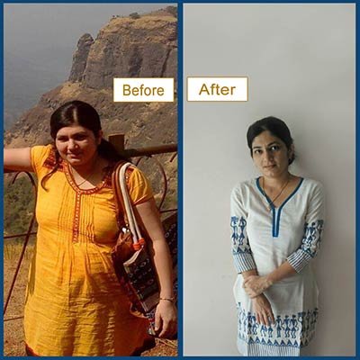 Before and After Transformation 2