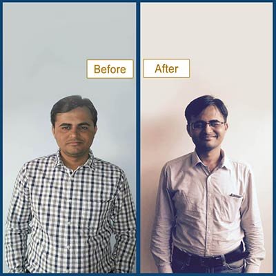 Before and After Transformation 3