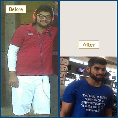 Before and After Transformation 4