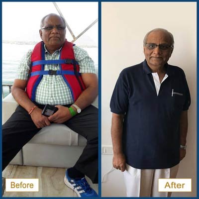 Before and After Transformation 5