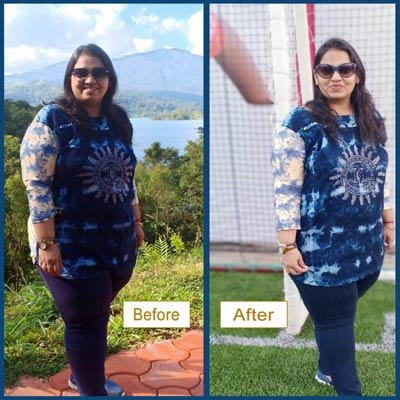 Before and After Transformation 6