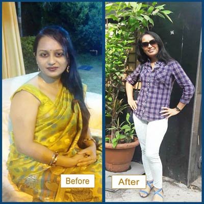 Before and After Transformation 7
