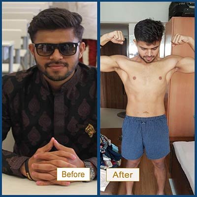 Before and After Transformation 8
