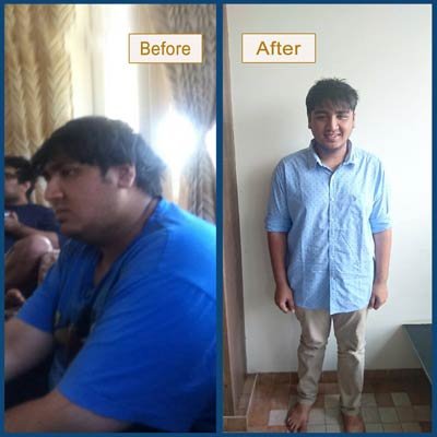 Before and After Transformation 9