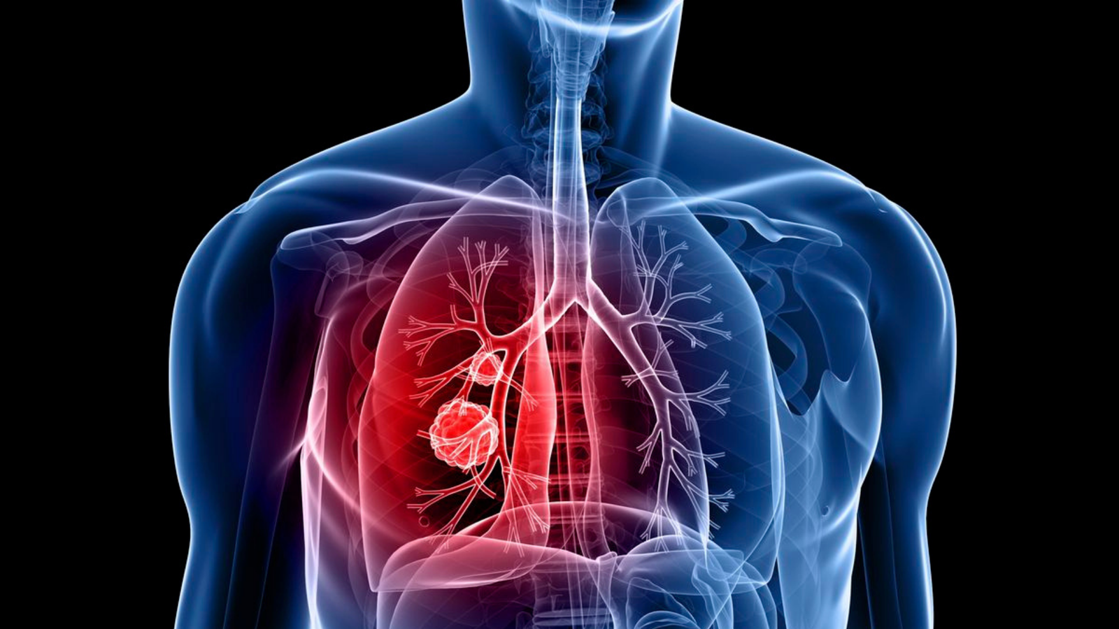 Respiratory Illness
