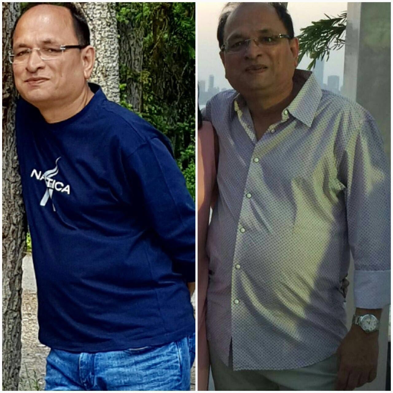 Before and After Transformation 9